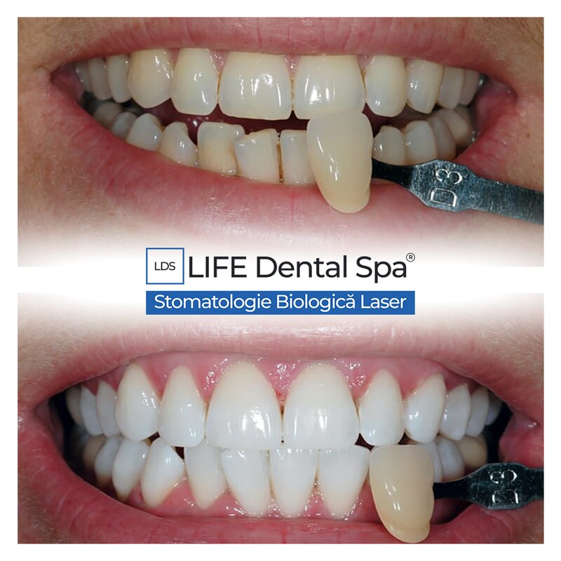 Life Dental Spa - Clinici Stomatologice Laser