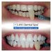 Life Dental Spa - Clinici Stomatologice Laser